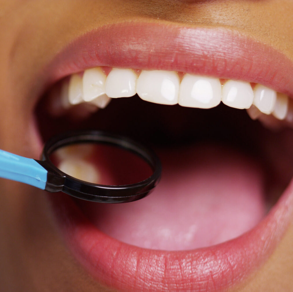 Close Up Of Smiling Black Woman At Dentist Close Up Of Smiling Black Woman At Dentist